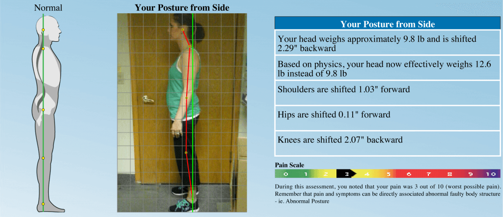 Posture Assesment